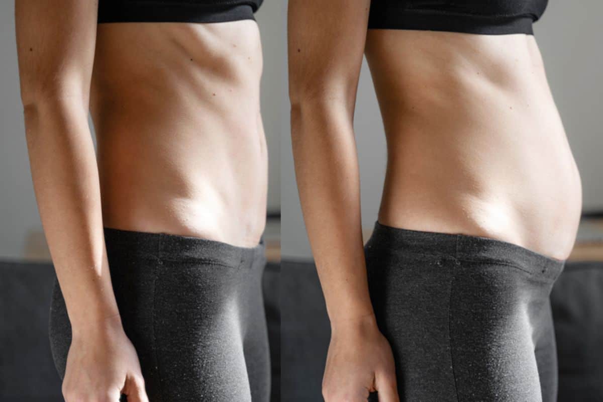 How long does diastasis recti take to improve Selly Oak?