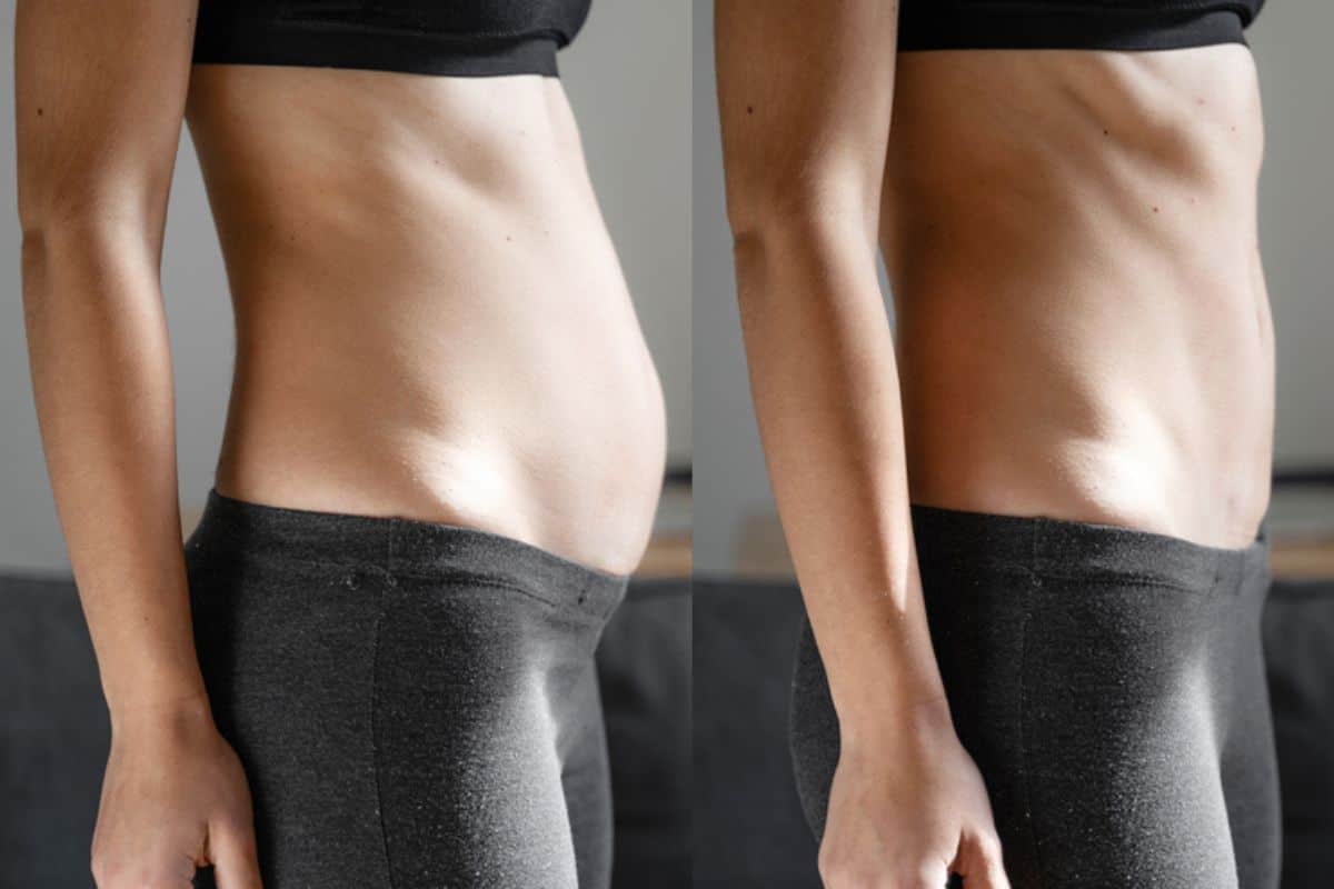 Post-Pregnancy: What Happens to Your Abdominal Muscles After Birth Selly Oak