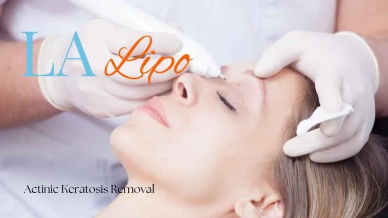 Woman receiving Actinic Keratosis Removal Treatment Selly Oak