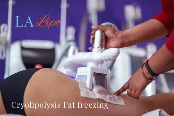 women getting fat freezing Selly Oak
