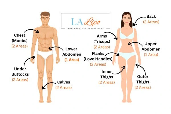 LA LIPO Cryolipolysis Areas Selly Oak