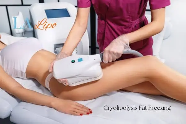 Woman receiving coolsculpting Selly Oak treatment on her thighs