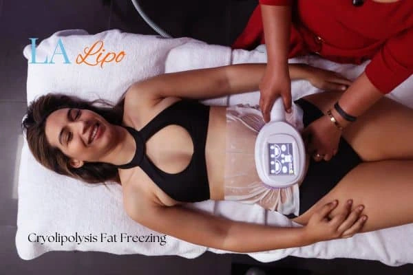 woman getting cryolipolysis Selly Oak