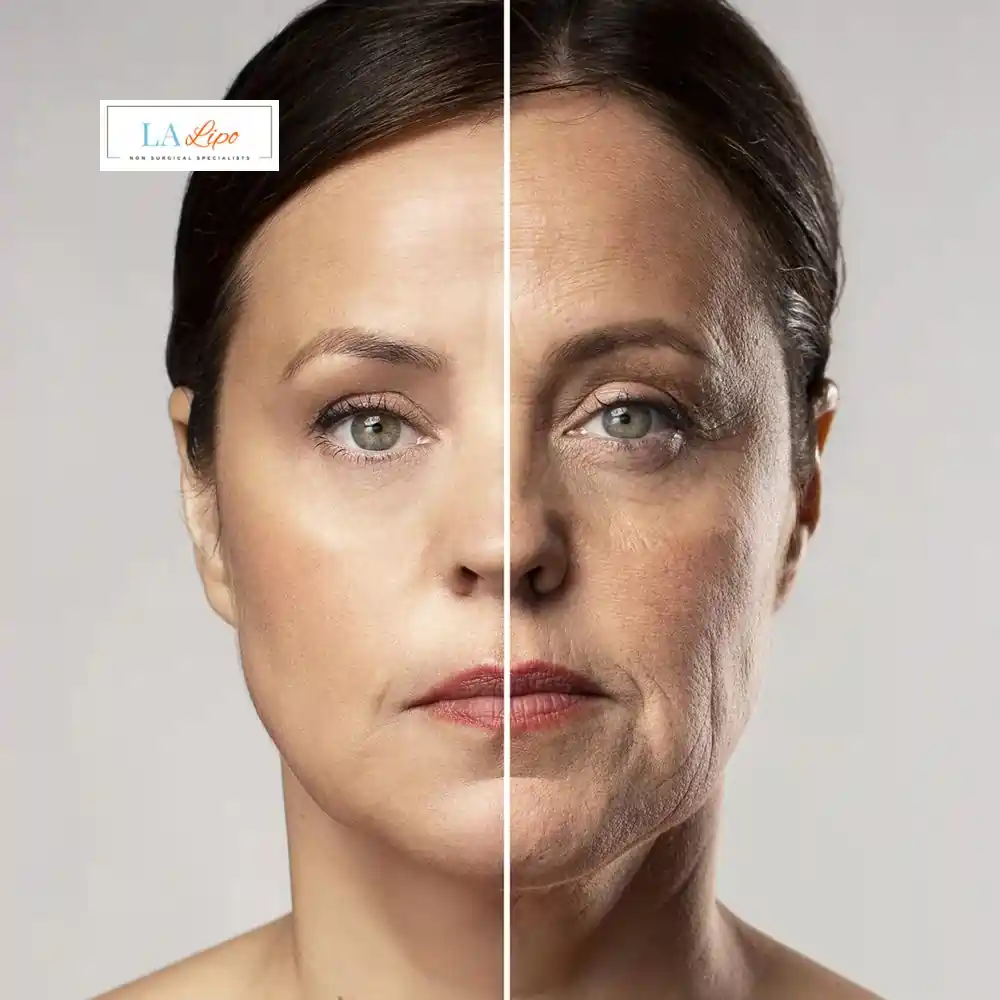 How Can You Tell If Non-Surgical Skin Tightening Is Right for You Selly Oak?