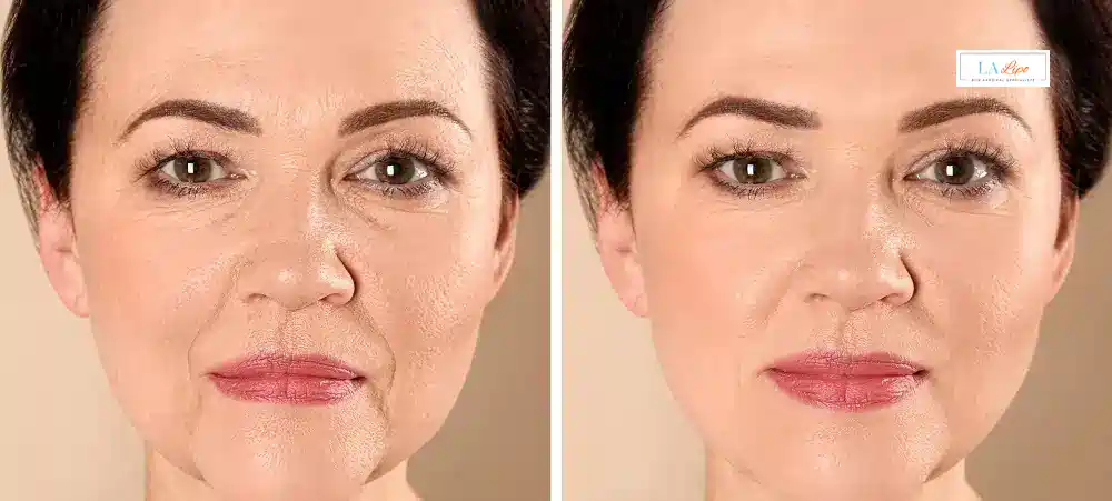How Long Does It Take to See Results and How Long Do They Last Selly Oak?
