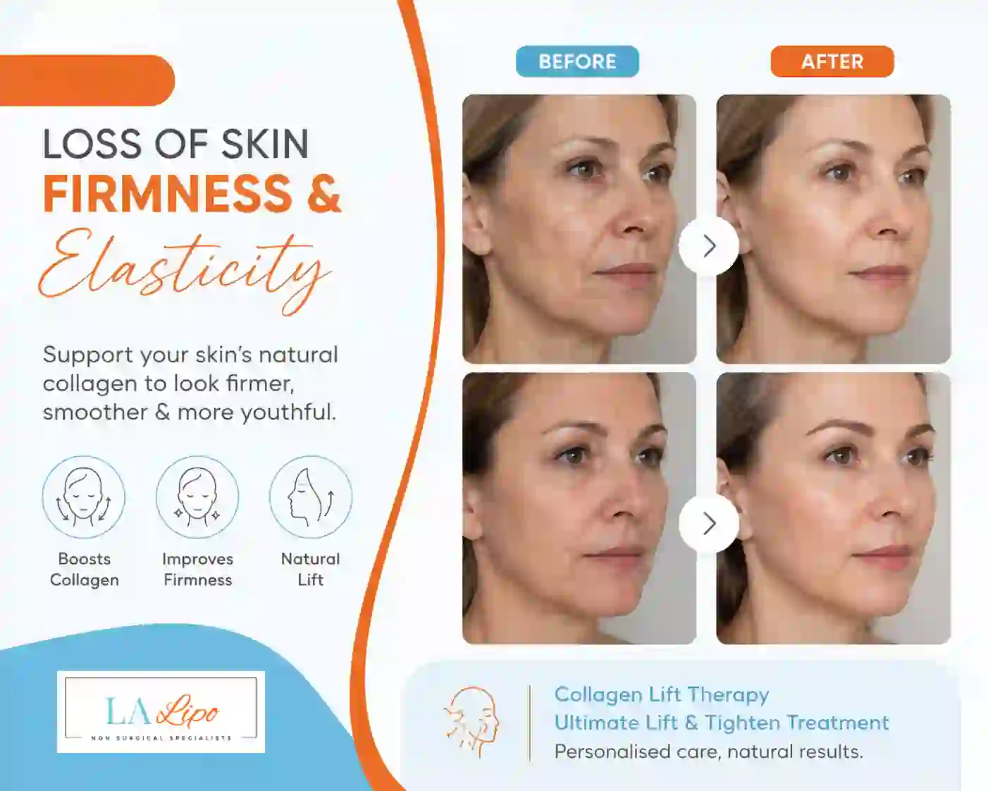 Sign #7: Loss of Skin Firmness and Elasticity Selly Oak