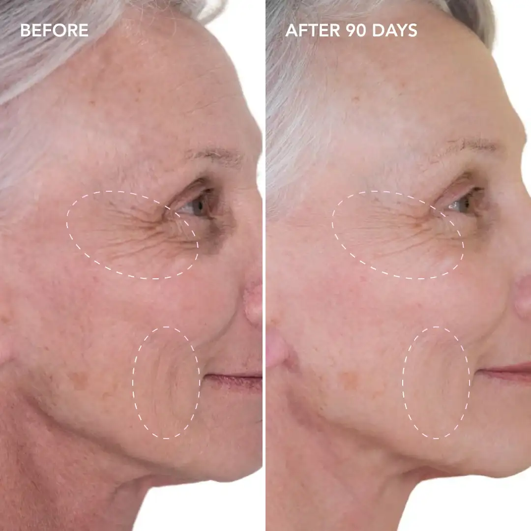 When will you see results Selly Oak